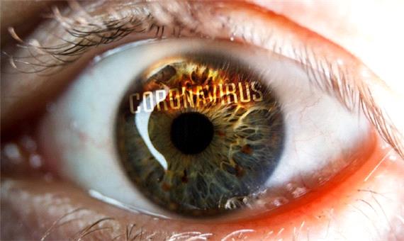 کشفی جالب درباره مقاومت قرنیه چشم دربرابر کرونا