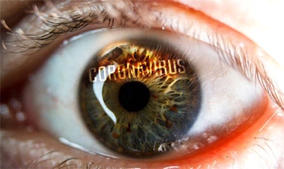 کشفی جالب درباره مقاومت قرنیه چشم در برابر کرونا