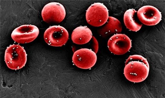 درمان سرطان با پوشاندن یاخته های خونی با نانوذرات دارویی