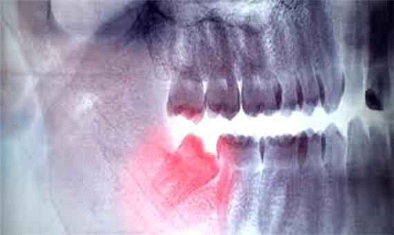 توجه به بهداشت دهان و دندان از سن 40 سالگی اهمیت بیشتری دارد