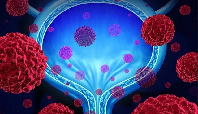 نقش مواد پروبیوتیک در عفونت‌های ادراری زنان