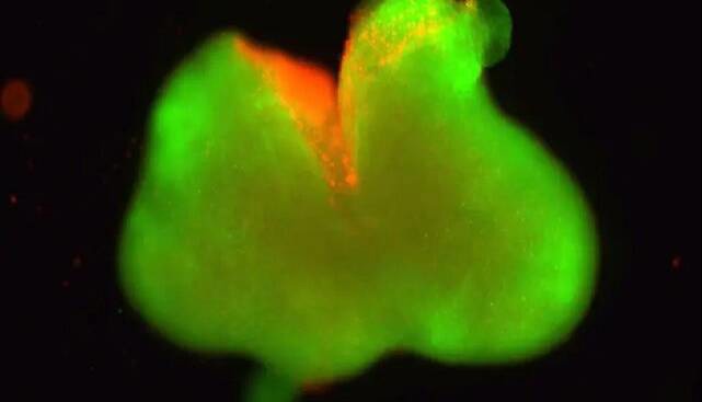 دستاوردی قابل توجه در ترمیم نخاع